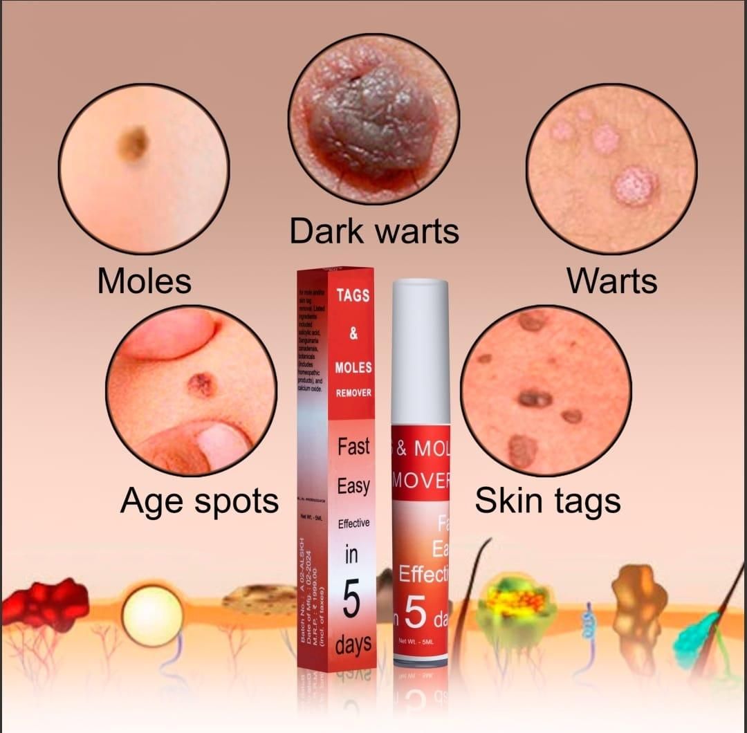 Professional Skin Tag & Mole Removal Device – Flawless Skin At Home - Vistora