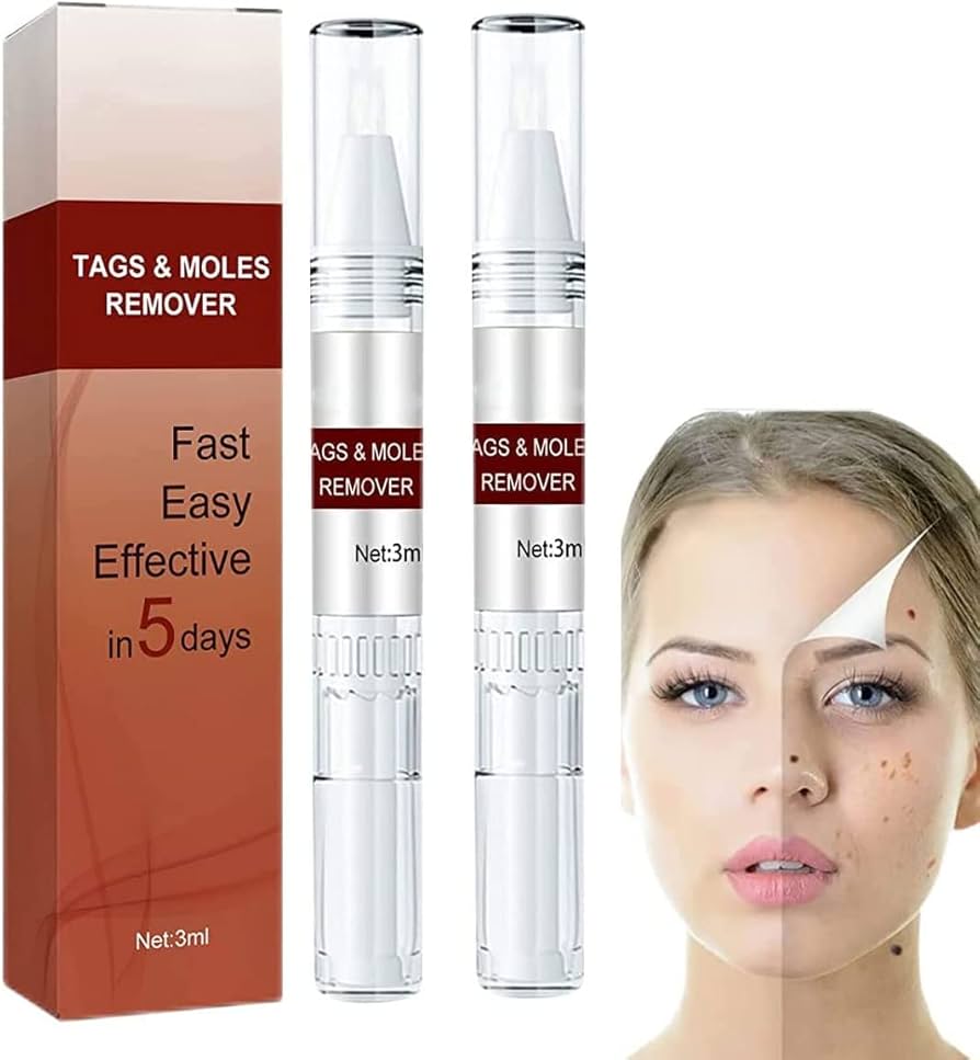 Professional Skin Tag & Mole Removal Device – Flawless Skin At Home - Vistora